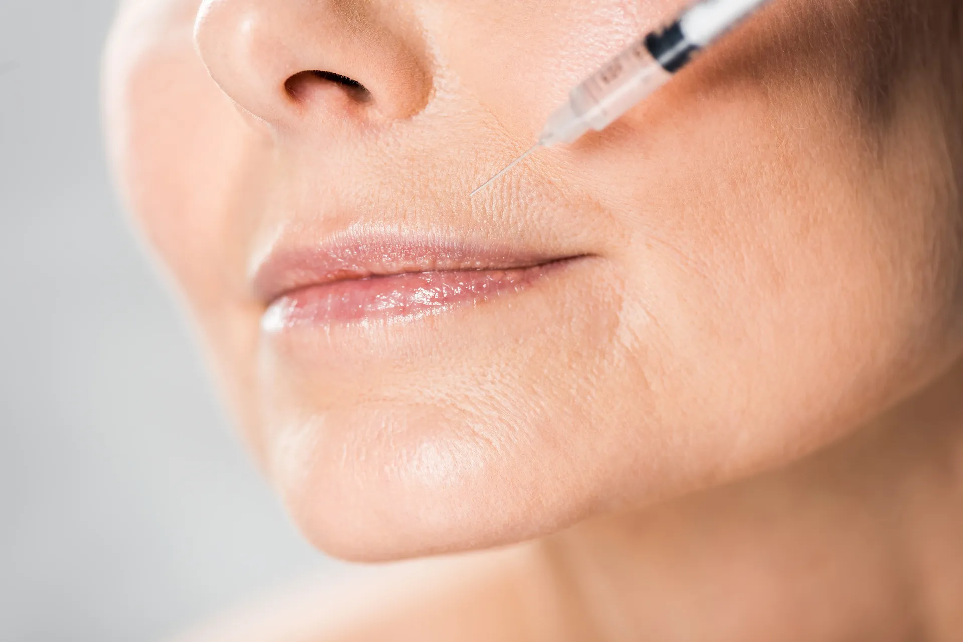 Aplicação de botox com segurança médica